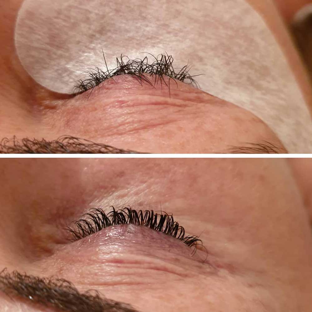 Lash Lift Side Effects and Risks: What If It Goes Wrong and How to Prevent It 3 bad lash lift and - Lash Lift Side Effects and Risks: What If It Goes Wrong and How to Prevent It - Beauty Art Pro