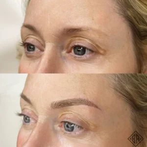 Avant et après le microblading et le microshading - beauty art pro