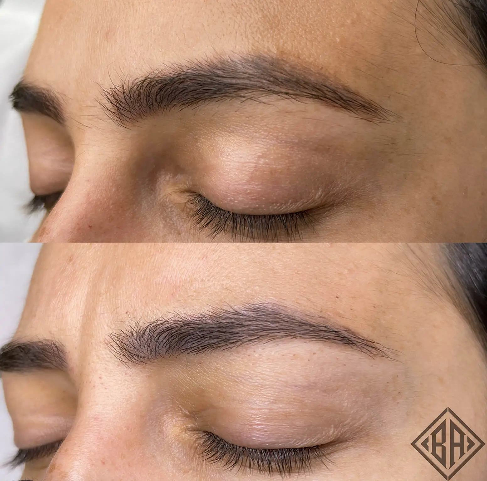 avant et après l'enlèvement du tatouage pmu - beauty art pro