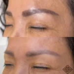 avant et après l'enlèvement du tatouage pmu - beauty art pro 2