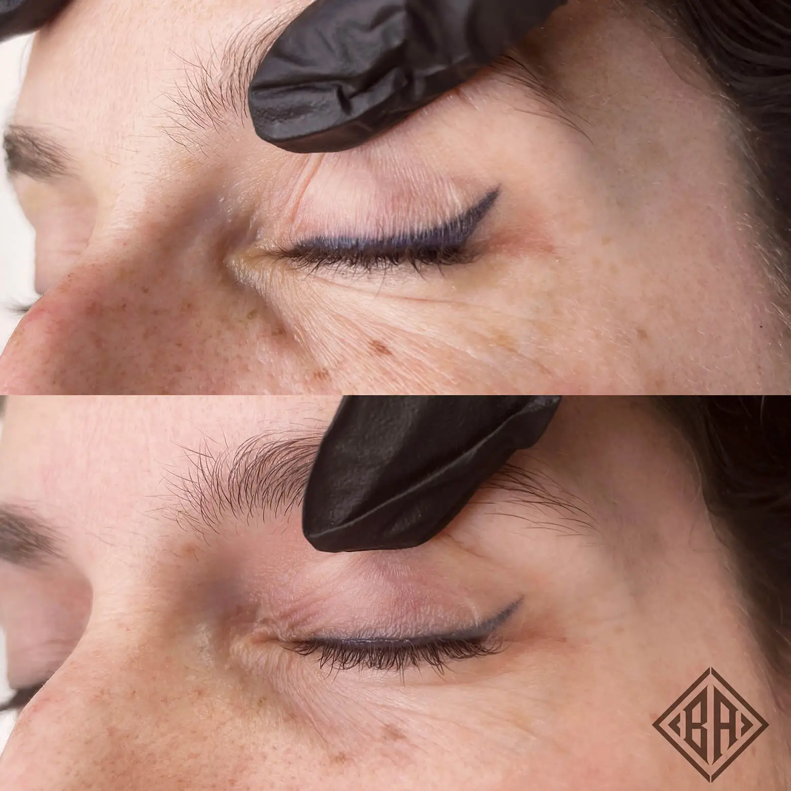 avant et après l'enlèvement du tatouage pmu - beauty art pro 3